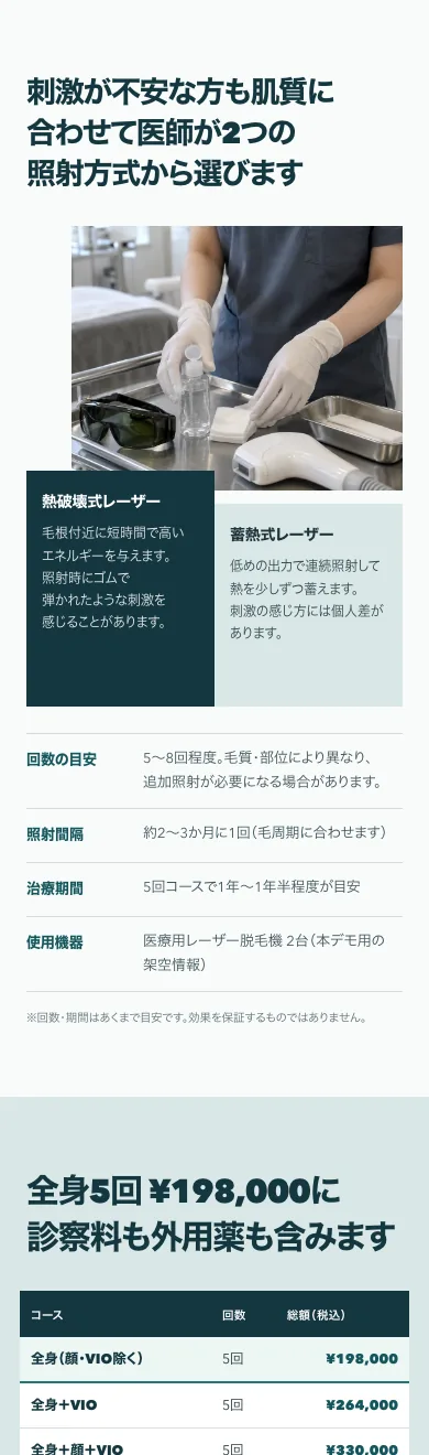 LUCEの照射方式と料金セクション